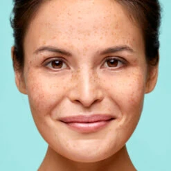 Biodermal Couperose Creme -Winkel Voor Gezondheidszorgproducten 978431 2